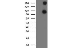 HEK293T cells were transfected with the pCMV6-ENTRY control (Left lane) or pCMV6-ENTRY ANAPC2 (Right lane) cDNA for 48 hrs and lysed. (ANAPC2 antibody)