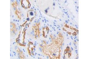 Used in DAB staining on fromalin fixed paraffin- embedded Kidney tissue (TBXAS1 antibody  (AA 357-533))