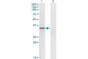 Western Blot analysis of HOXD1 expression in transfected 293T cell line by HOXD1 monoclonal antibody (M01), clone 4F4.