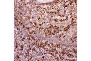 Anti-CD11b Picoband antibody ,  IHC(P): Human Tonsil Tissue (CD11b antibody  (AA 17-382))