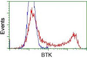 Image no. 5 for anti-Bruton Agammaglobulinemia tyrosine Kinase (BTK) antibody (ABIN1496972) (BTK antibody)