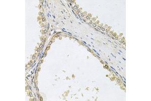 Immunohistochemistry of paraffin-embedded human prostate using POMGNT1 antibody at dilution of 1:100 (x40 lens).