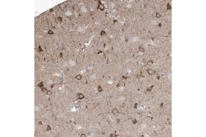 Immunohistochemical staining of human cerebral cortex with GTPBP8 polyclonal antibody  shows strong cytoplasmic positivity in neuronal cells.