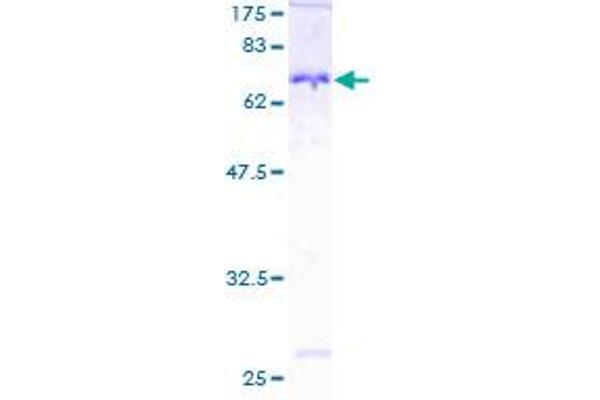 NDRG1 Protein (AA 1-394) (GST tag)