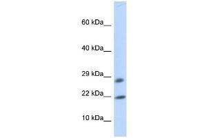WB Suggested Anti-OCIAD2 Antibody Titration: 0. (OCIAD2 antibody  (Middle Region))