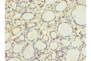 Immunohistochemistry of paraffin-embedded human thyroid tissue using ABIN7152056 at dilution of 1:100 (Ethanolamine Kinase 1 antibody  (AA 90-258))