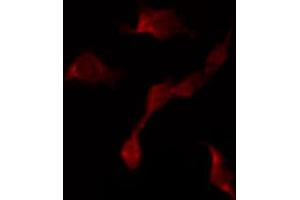 ABIN6267442 staining NIH-3T3 by IF/ICC. (RPS6KB1 antibody  (pThr421))
