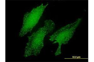 Immunofluorescence of monoclonal antibody to LMO3 on HeLa cell. (LMO3 antibody  (AA 91-146))