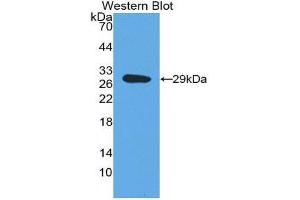 Western Blotting (WB) image for anti-Dopamine beta-Hydroxylase (Dopamine beta-Monooxygenase) (DBH) (AA 335-571) antibody (ABIN1858608) (DBH antibody  (AA 335-571))