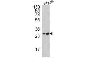 Western blot analysis of BCL2L11 Antibody (Center) in K562, HL-60 cell line lysates (35ug/lane). (BIM antibody  (Middle Region))
