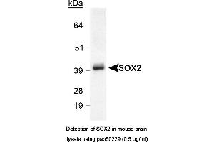 Image no. 2 for anti-SRY (Sex Determining Region Y)-Box 2 (SOX2) (AA 1-100), (N-Term) antibody (ABIN363538) (SOX2 antibody  (N-Term))