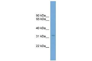 WB Suggested Anti-TCEA2 Antibody Titration: 0. (TCEA2 antibody  (N-Term))