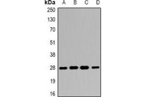 Western blot analysis of 14-3-3 beta expression in SW480 (A), HepG2 (B), mouse liver (C), mouse kidney (D) whole cell lysates. (YWHAB antibody)