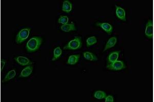 Immunofluorescent analysis of A549 cells using ABIN7144954 at dilution of 1:100 and Alexa Fluor 488-congugated AffiniPure Goat Anti-Rabbit IgG(H+L) (PFKM antibody  (AA 166-334))
