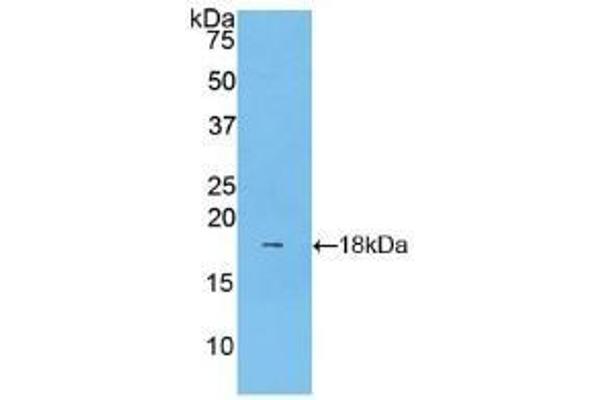 LCAT antibody  (AA 290-433)