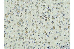 IHC analysis of Rpl9 using anti-Rpl9 antibody (ABIN7599060). (RPL9 antibody  (AA 1-192))
