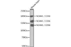 Western blot analysis of extracts of mouse brain, using NC / CD56 antibody (ABIN1679098, ABIN3015129 and ABIN7101312). (CD56 antibody)