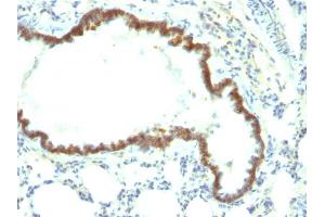 Formalin-fixed, paraffin-embedded Rat Lung stained with Ep-CAM Monoclonal Antibody (Epcam/1158). (EpCAM antibody)