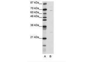KLHL13 antibody  (N-Term)