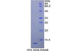 SDS-PAGE analysis of Human Proteoglycan 4 Protein. (Proteoglycan 4 Protein (PRG4))