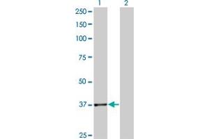 JMJD7-PLA2G4B antibody  (AA 1-316)