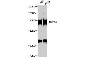 Western blot analysis of extracts of various cell lines, using HDAC6 antibody (ABIN5970867) at 1/1000 dilution. (HDAC6 antibody)