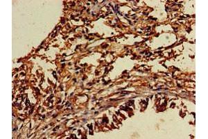 Immunohistochemistry of paraffin-embedded human lung tissue using ABIN7174052 at dilution of 1:100 (TYRO3 antibody  (AA 728-873))