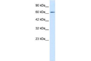 WB Suggested Anti-FLJ12644 Antibody Titration:  1. (FLJ12644 (C-Term) antibody)