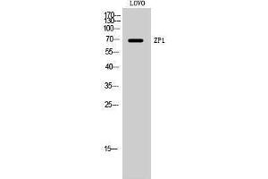Western Blotting (WB) image for anti-Zona Pellucida Glycoprotein 1 (ZP1) (Internal Region) antibody (ABIN3187575)