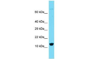 Host: Rabbit  Target Name: Mpc1  Sample Tissue: Rat Spleen lysates  Antibody Dilution: 1. (BRP44L antibody  (N-Term))