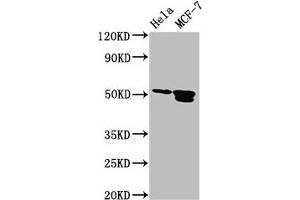 Western Blot Positive WB detected in: Hela whole cell lysate, MCF-7 whole cell lysate All lanes: TFAP2B antibody at 3. (TFAP2B antibody  (AA 111-208))