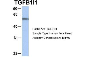 Western Blotting (WB) image for anti-Transforming Growth Factor beta 1 Induced Transcript 1 (TGFB1I1) (Middle Region) antibody (ABIN2777947)