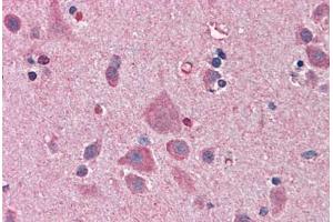 Human Brain, Cortex: Formalin-Fixed, Paraffin-Embedded (FFPE) (NDN antibody  (AA 222-322))