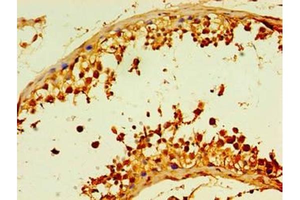 DCP2 antibody  (AA 1-385)