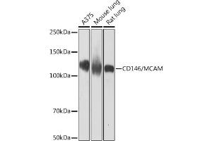 Western blot analysis of extracts of various cell lines, using CD146/MCAM Rabbit mAb (ABIN7268460) at 1:1000 dilution. (MCAM antibody)