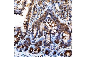 IHC analysis of Rab4/RAB4A using anti-Rab4/RAB4A antibody (ABIN7599733). (Rab4 antibody  (AA 110-216))