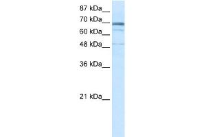 WB Suggested Anti-ZNF614 Antibody Titration:  0. (ZNF614 antibody  (N-Term))