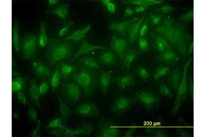 Immunofluorescence of monoclonal antibody to CKB on HeLa cell. (CKB antibody  (AA 1-381))