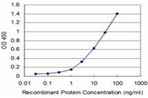 Detection limit for recombinant GST tagged CARF is approximately 1ng/ml as a capture antibody. (CDKN2AIP antibody  (AA 1-579))