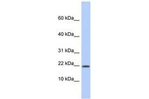 Image no. 1 for anti-Host Cell Factor C1 Regulator 1 (XPO1 Dependent) (HCFC1R1) (AA 35-84) antibody (ABIN6743989) (HCFC1R1 antibody  (AA 35-84))