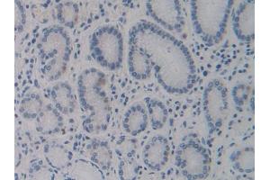 DAB staining on IHC-P; Samples: Human Stomach Tissue (CYP24A1 antibody  (AA 37-250))
