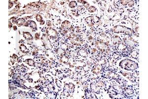 Formalin-fixed and paraffin embedded rat esophagus labeled with Anti-SOX2 Polyclonal Antibody, Unconjugated (ABIN669621) at 1:200 followed by conjugation to the secondary antibody and DAB staining (SOX2 antibody  (AA 227-317))