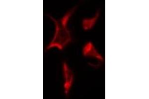 ABIN6272292 staining HuvEc by IF/ICC. (TCEB3 antibody  (N-Term))