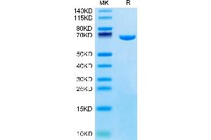 Albumin Protein (ALB) (AA 25-608) (His tag)