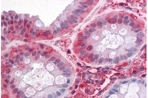 Human Colon: Formalin-Fixed, Paraffin-Embedded (FFPE) (SLC1A5 antibody  (Internal Region))