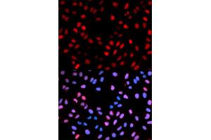 Immunofluorescence analysis of U2OS cells using Phospho-RAF1-S621 antibody (ABIN5969931). (RAF1 antibody  (pSer621))