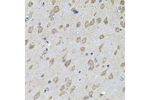 Immunohistochemistry of paraffin-embedded mouse brain using NFU1 Antibody (ABIN2564134) at dilution of 1:100 (40x lens). (NFU1 antibody)