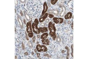 Immunohistochemical staining of human kidney shows strong cytoplasmic and luminal positivity in tubular cells.