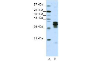 Western Blotting (WB) image for anti-Heterogeneous Nuclear Ribonucleoprotein D (HNRNPD) (C-Term) antibody (ABIN2778693)