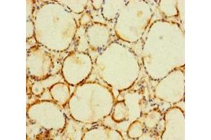 Immunohistochemistry of paraffin-embedded human thyroid tissue using ABIN7174776 at dilution of 1:100 (C1orf112 antibody  (AA 301-530))